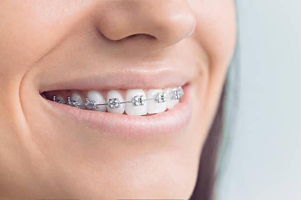 Best Veneers and Lumineers  in South Tucson, AZ